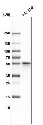 Western Blot: NDP52 Antibody [NBP1-87872] - Analysis in human cell line HDLM-2.