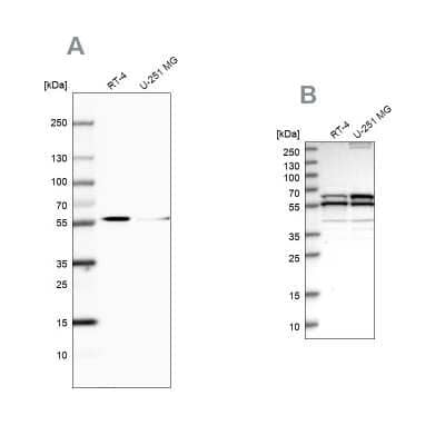 <b>Independent Antibodies Validation and Orthogonal Strategies Validation.</b>Western Blot: NDP52 Antibody [NBP1-87872] - Analysis using Anti-CALCOCO2 antibody NBP1-87872 (A) shows similar pattern to independent antibody NBP1-87874 (B).