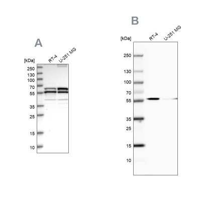 Western Blot: NDP52 Antibody [NBP1-87874] - Analysis using Anti-CALCOCO2 antibody NBP1-87874 (A) shows similar pattern to independent antibody NBP1-87872 (B).