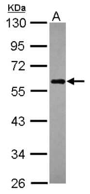 Western Blot: NDP52 Antibody [NBP2-19499] - Sample (30 ug of whole cell lysate) A: Raji 10% SDS PAGE gel, diluted at 1:1000.