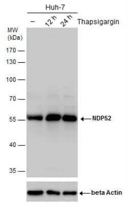 <b>Biological Strategies Validation. </b>Western Blot: NDP52 Antibody [NBP2-19499] - NDP52 antibody detects NDP52 protein by western blot analysis. Un-treated (-) and treated (+), Thapsigargin treatment for 12hrs and 24hrs. Huh-7 whole cell extracts (30 ug) were separated by 10% SDS-PAGE, and the membrane was blotted with NDP52 antibody.ACTB was used as internal control, shown at the bottom panel. HRP-conjugated anti-rabbit IgG antibody was used to detect the primary antibody.