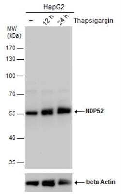 Western Blot: NDP52 Antibody [NBP2-19499] - NDP52 antibody detects NDP52 protein by western blot analysis. Un-treated (-) and treated (+, Thapsigargin treatment for 12hrs and 24hrs) HepG2 whole cell extracts (30 ug) were separated by 10% SDS-PAGE, and the membrane was blotted with NDP52 antibody.The ACTB was used as internal control, shown at the bottom panel. HRP-conjugated anti-rabbit IgG antibody was used to detect the primary antibody.