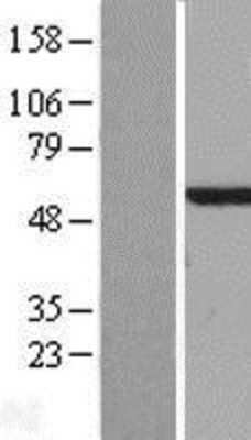 Western Blot NDP52 Overexpression Lysate