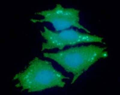 Immunocytochemistry/Immunofluorescence: NDRG1 Antibody (11G4) [NBP2-59415] - Analysis of NDRG1 in HeLa cells line, stained with DAPI (Blue) for nucleus staining and monoclonal anti-human  NDRG1 antibody (1:100) with goat anti-mouse IgG-Alexa fluor 488 conjugate (Green).