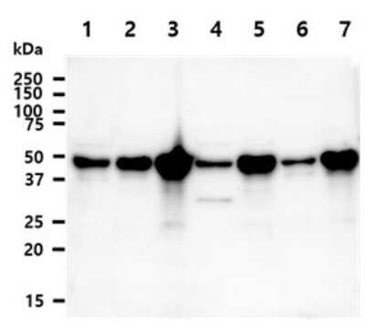 Western Blot: NDRG1 Antibody (11G4) [NBP2-59415] - Lane 1: LnCaP cell lysates, Lane 2: HeLa cell lysates, Lane 3: PC3 cell lysates, Lane 4: Hep3B cell lysates, Lane 5: HT1080 cell lysates, Lane 6: Jurkat cell lysates, Lane 7: SW480 cell lysates