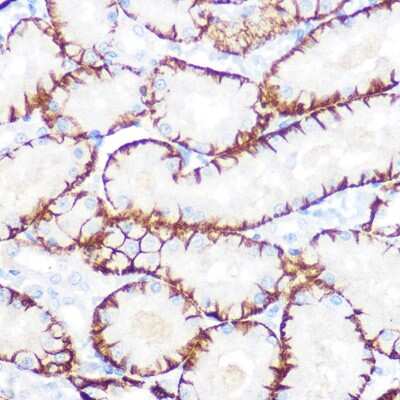 Immunohistochemistry-Paraffin: NDRG1 Antibody (2C6K6) [NBP3-16321] - Immunohistochemistry of paraffin-embedded rat kidney using NDRG1 Rabbit mAb (NBP3-16321) at dilution of 1:100 (40x lens).Perform microwave antigen retrieval with 10 mM PBS buffer pH 7.2 before commencing with IHC staining protocol.