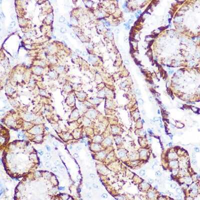 Immunohistochemistry-Paraffin: NDRG1 Antibody (2C6K6) [NBP3-16321] - Immunohistochemistry of paraffin-embedded mouse kidney using NDRG1 Rabbit mAb (NBP3-16321) at dilution of 1:100 (40x lens).Perform microwave antigen retrieval with 10 mM PBS buffer pH 7.2 before commencing with IHC staining protocol.