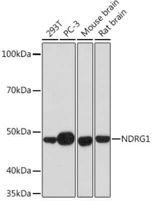 Western Blot: NDRG1 Antibody (2C6K6) [NBP3-16321] - Western blot analysis of extracts of various cell lines, using NDRG1 Rabbit mAb (NBP3-16321) at 1:1000 dilution. Secondary antibody: HRP Goat Anti-Rabbit IgG (H+L) at 1:10000 dilution. Lysates/proteins: 25ug per lane. Blocking buffer: 3% nonfat dry milk in TBST. Detection: ECL Basic Kit. Exposure time: 30s.