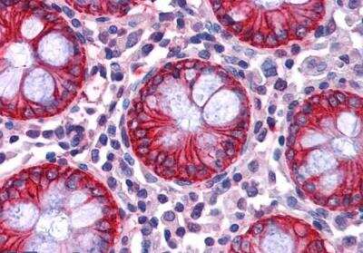 Immunohistochemistry-Paraffin: NDRG1 Antibody [NB300-839] - staining of paraffin embedded Human Colon. Steamed antigen retrieval with citrate buffer pH 6, AP-staining.