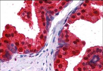 Immunohistochemistry-Paraffin: NDRG1 Antibody [NB300-839] -  staining of paraffin embedded Human Prostate. Steamed antigen retrieval with citrate buffer pH 6, AP-staining.