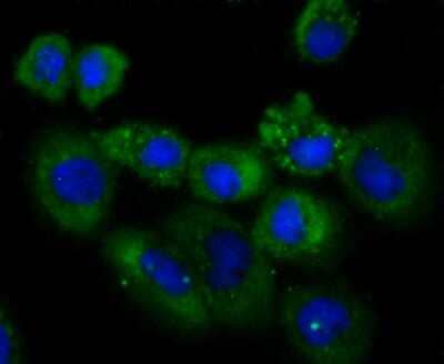 Immunocytochemistry/Immunofluorescence: NDRG1 Antibody (JM32-02) [NBP2-66969] - Staining NDRG1 in A431 cells (green). The nuclear counter stain is DAPI (blue). Cells were fixed in paraformaldehyde, permeabilised with 0.25% Triton X100/PBS.