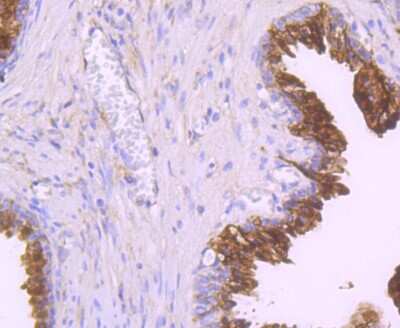 Immunohistochemistry-Paraffin: NDRG1 Antibody (JM32-02) [NBP2-66969] - Analysis of paraffin-embedded human prostate tissue using anti-NDRG1 antibody. Counter stained with hematoxylin.