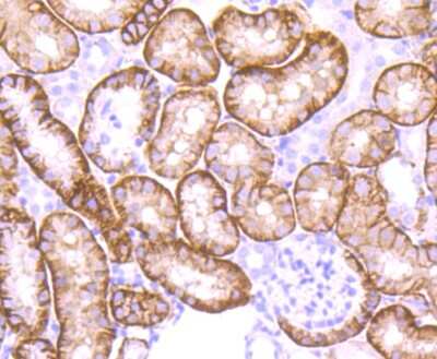 Immunohistochemistry-Paraffin: NDRG1 Antibody (JM32-02) [NBP2-66969] - Analysis of paraffin-embedded mouse kidney tissue using anti-NDRG1 antibody. Counter stained with hematoxylin.