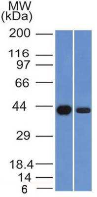 Western Blot: NDRG1 Antibody (NDRG1/1383) [NBP2-48475] - Analysis of Kidney and HeLa Cell Lysate using   NDRG1 Monoclonal Antibody (NDRG1/1383)  