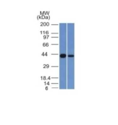 Western Blot: NDRG1 Antibody (NDRG1/1383) [NBP2-54550] - Kidney and HeLa Cell Lysate using NDRG1 Monoclonal Antibody (NDRG1/1383)