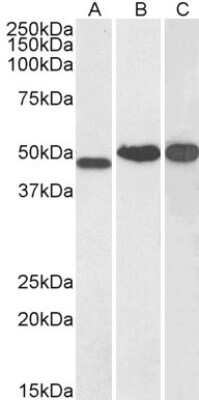 Western Blot: NDRG1 Antibody [NB300-839] - (0.1ug/ml) staining of Human Kidney (A), Cerebellum (B) and Testis (C) lysate (35ug protein in RIPA buffer). Primary incubation was 1 hour. Detected by chemiluminescence.