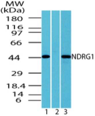 Western Blot: NDRG1 Antibody [NBP2-24478] - Analysis of NDRG1 in HEPG2 cell lysate in the 1) absence and 2) presence of immunizing peptide and 3) RAW using this antibody. 4.0 ug/ml and 6.0 ug/ml, respectively.