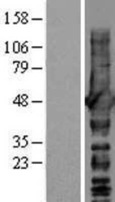 Western Blot: NDRG1 Overexpression Lysate (Adult Normal) [NBL1-13529] Left-Empty vector transfected control cell lysate (HEK293 cell lysate); Right -Over-expression Lysate for NDRG1.