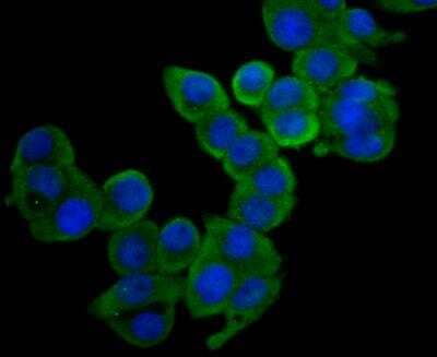 Immunocytochemistry/Immunofluorescence: NDRG2 Antibody [NBP2-76951] - ICC staining NDRG2 in LOVO cells (green). The nuclear counter stain is DAPI (blue). Cells were fixed in paraformaldehyde, permeabilised with 0.25% Triton X100/PBS.