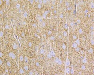 Immunohistochemistry: NDRG2 Antibody [NBP2-76951] - Immunohistochemical analysis of paraffin-embedded rat brain tissue using anti-NDRG2 antibody. Counter stained with hematoxylin.