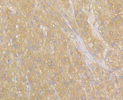 Immunohistochemistry: NDRG2 Antibody [NBP2-76951] - Immunohistochemical analysis of paraffin-embedded human liver tissue using anti-NDRG2 antibody. Counter stained with hematoxylin.