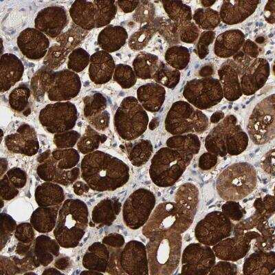 Immunohistochemistry-Paraffin: NDRG2 Antibody [NBP1-81425] - Staining of human salivary gland shows cytoplasmic positivity in glandular cells.