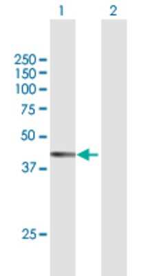 Western Blot: NDRG2 Antibody [H00057447-B01P] - Analysis of NDRG2 expression in transfected 293T cell line by NDRG2 polyclonal antibody.  Lane 1: NDRG2 transfected lysate(39.6 KDa). Lane 2: Non-transfected lysate.