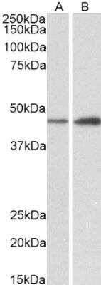 Western Blot: NDRG2 Antibody [NBP1-72052] - Staining of Mouse (A) and Rat (B) Brain lysates (35 ug protein in RIPA buffer). Primary incubation was 1 hour. Detected by chemiluminescence.