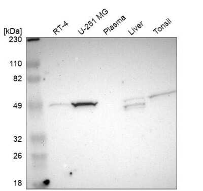 Western Blot: NDRG2 Antibody [NBP1-81425] - Analysis in human cell line RT-4, human cell line U-251 MG, human plasma, human liver tissue and human tonsil tissue.