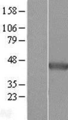 Western Blot: NDRG2 Overexpression Lysate (Adult Normal) [NBL1-13531] Left-Empty vector transfected control cell lysate (HEK293 cell lysate); Right -Over-expression Lysate for NDRG2.