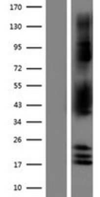Western Blot: NDRG2 Overexpression Lysate (Adult Normal) [NBP2-04589] Left-Empty vector transfected control cell lysate (HEK293 cell lysate); Right -Over-expression Lysate for NDRG2.