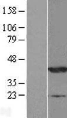 Western Blot: NDRG2 Overexpression Lysate (Adult Normal) [NBP2-04591] Left-Empty vector transfected control cell lysate (HEK293 cell lysate); Right -Over-expression Lysate for NDRG2.