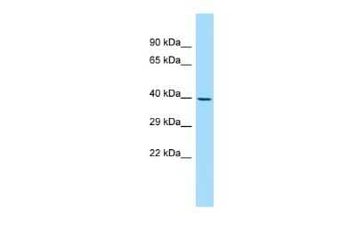 Western Blot: NDRG3 Antibody [NBP2-85362] - WB Suggested Anti-NDRG3 Antibody. Titration: 1.0 ug/ml. Positive Control: OVCAR-3 Whole CellNDRG3 is strongly supported by BioGPS gene expression data to be expressed in Human OVCAR3 cells