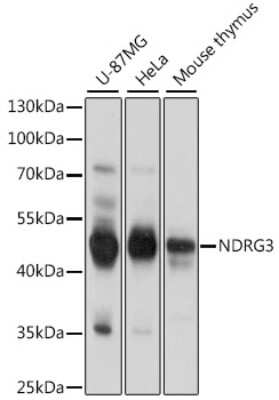 Western Blot: NDRG3 Antibody [NBP2-94331] - Analysis of extracts of various cell lines, using NDRG3 at 1:1000 dilution.Secondary antibody: HRP Goat Anti-Rabbit IgG (H+L) at 1:10000 dilution.Lysates/proteins: 25ug per lane.Blocking buffer: 3% nonfat dry milk in TBST.Detection: ECL Basic Kit .Exposure time: 1s.