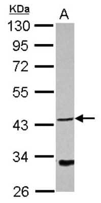 Western Blot: NDRG4 Antibody [NBP2-19500] - Sample (30 ug of whole cell lysate) A: Jurakt 10% SDS PAGE gel, diluted at 1:1000.