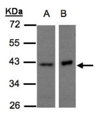 Western Blot: NDUFA10 Antibody [NBP1-32146] - Sample(30 ug of whole cell lysate)A:H1299 B:Raji 10% SDS PAGE, antibody diluted at 1:500.