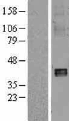 Western Blot: NDUFA10 Overexpression Lysate (Adult Normal) [NBL1-13535] Left-Empty vector transfected control cell lysate (HEK293 cell lysate); Right -Over-expression Lysate for NDUFA10.