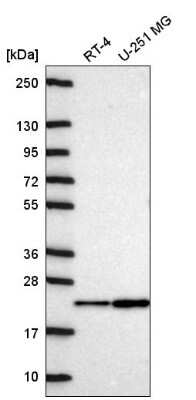 Western Blot NDUFA11 Antibody