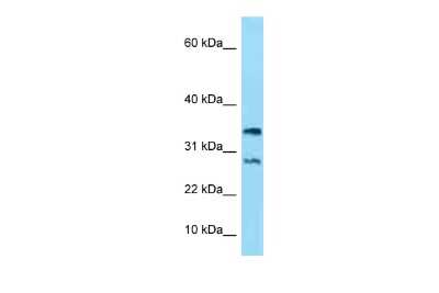 Western Blot: NDUFA11 Antibody [NBP2-83261] - WB Suggested Anti-NDUFA11 Antibody. Titration: 1.0 ug/ml. Positive Control: ACHN Whole Cell