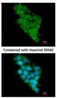 Immunocytochemistry/Immunofluorescence: NDUFA12 Antibody [NBP1-32745] - Immunofluorescence analysis of methanol-fixed HepG2, using NDUFA12 antibody at 1:200 dilution.