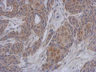 Immunohistochemistry-Paraffin: NDUFA12 Antibody [NBP1-32745] - Cal27 xenograft, using NDUFA12 antibody at 1:500 dilution. Antigen Retrieval: Trilogy™ (EDTA based, pH 8.0) buffer, 15min.