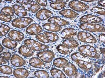 Immunohistochemistry-Paraffin: NDUFA12 Antibody [NBP1-32745] - NDUFA12 Antibody detects NDUFA12 protein at mitochondria in rat colon by immunohistochemical analysis. Sample: Paraffin-embedded rat colon. NDUFA12 Antibody diluted at 1:500.