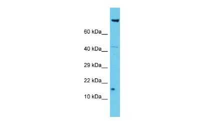 Western Blot: NDUFA12 Antibody [NBP2-85363] - Host: Rabbit. Target Name: NDUFA12. Sample Type: Jurkat Whole Cell lysates. Antibody Dilution: 1.0ug/ml