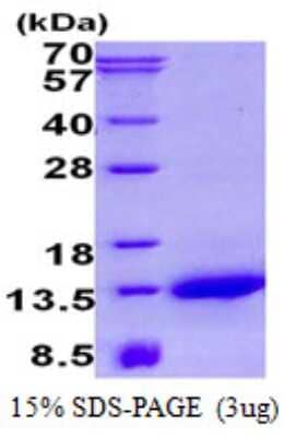 SDS-Page: NDUFA2 Protein [NBP2-23259]