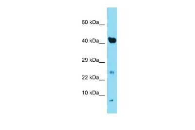 Western Blot: NDUFA3 Antibody [NBP2-85364] - Host: Rabbit. Target Name: Ndufa3. Sample Type: Mouse Heart lysates. Antibody Dilution: 1.0ug/ml