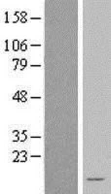 Western Blot: NDUFA3 Overexpression Lysate (Adult Normal) [NBL1-13540] Left-Empty vector transfected control cell lysate (HEK293 cell lysate); Right -Over-expression Lysate for NDUFA3.