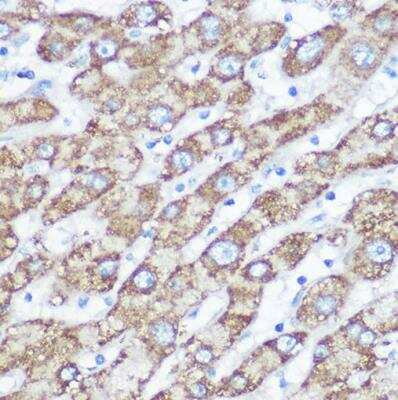 Immunohistochemistry-Paraffin NDUFA4 Antibody - Azide and BSA Free