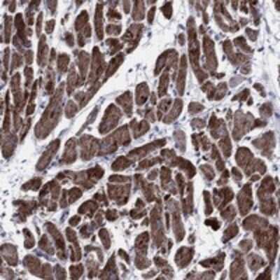 Immunohistochemistry-Paraffin NDUFA4 Antibody