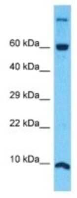 Western Blot: NDUFA4 Antibody [NBP3-09939] - Western blot analysis of NDUFA4 in 721_B Whole Cell lysates. Antibody dilution at 1.0ug/ml