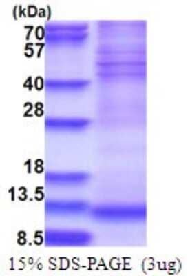 SDS-PAGE Recombinant Human NDUFA4 His Protein